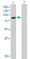 Protein CBFA2T3 antibody, H00000863-B01P, Novus Biologicals, Western Blot image 