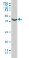 Adrenoceptor Alpha 1A antibody, H00000148-M01, Novus Biologicals, Western Blot image 