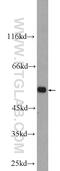 Vitamin K-dependent protein C antibody, 25382-1-AP, Proteintech Group, Western Blot image 