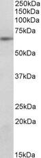 Suppressor Of Cytokine Signaling 5 antibody, GTX89655, GeneTex, Western Blot image 