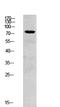 Spleen Associated Tyrosine Kinase antibody, STJ99608, St John