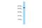 Chordin Like 2 antibody, A10489, Boster Biological Technology, Western Blot image 