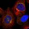 Transmembrane Protein 87B antibody, HPA035183, Atlas Antibodies, Immunofluorescence image 