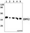 Double PHD Fingers 2 antibody, A07556-2, Boster Biological Technology, Western Blot image 