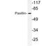 Paxillin antibody, LS-C177637, Lifespan Biosciences, Western Blot image 