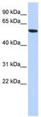 Zinc Finger Protein 248 antibody, TA339526, Origene, Western Blot image 