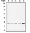 Troponin I3, Cardiac Type antibody, LS-C352958, Lifespan Biosciences, Western Blot image 