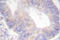 CF Transmembrane Conductance Regulator antibody, AP06511PU-N, Origene, Immunohistochemistry paraffin image 