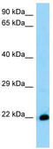 THEM6 antibody, TA342024, Origene, Western Blot image 