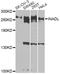 PATJ Crumbs Cell Polarity Complex Component antibody, A8476, ABclonal Technology, Western Blot image 