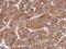 Matrix Metallopeptidase 8 antibody, NBP2-17316, Novus Biologicals, Immunohistochemistry frozen image 