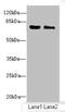 CBFA2/RUNX1 Partner Transcriptional Co-Repressor 2 antibody, LS-C675464, Lifespan Biosciences, Western Blot image 
