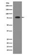 Transferrin antibody, M00094, Boster Biological Technology, Western Blot image 