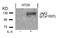 Janus Kinase 2 antibody, 79-174, ProSci, Western Blot image 