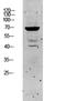 Keratin 5 antibody, STJ99636, St John
