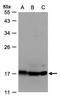 ATP Synthase F1 Subunit Delta antibody, LS-C185409, Lifespan Biosciences, Western Blot image 