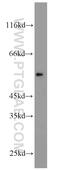 Cholinergic Receptor Nicotinic Beta 1 Subunit antibody, 11553-1-AP, Proteintech Group, Western Blot image 