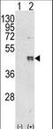 CCAAT Enhancer Binding Protein Beta antibody, LS-C168649, Lifespan Biosciences, Western Blot image 