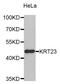 Keratin 23 antibody, MBS126277, MyBioSource, Western Blot image 