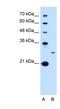 Tetraspanin 15 antibody, NBP1-62314, Novus Biologicals, Western Blot image 