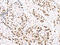 C-Terminal Binding Protein 2 antibody, CSB-PA549967, Cusabio, Immunohistochemistry paraffin image 