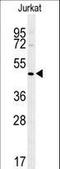 ST3 Beta-Galactoside Alpha-2,3-Sialyltransferase 5 antibody, LS-C161530, Lifespan Biosciences, Western Blot image 