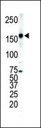 Erb-B2 Receptor Tyrosine Kinase 4 antibody, LS-C97506, Lifespan Biosciences, Western Blot image 