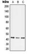 LIM Homeobox Transcription Factor 1 Beta antibody, LS-C352465, Lifespan Biosciences, Western Blot image 
