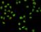 Chromodomain Helicase DNA Binding Protein 3 antibody, MA5-24760, Invitrogen Antibodies, Immunocytochemistry image 