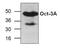 POU Class 5 Homeobox 1 antibody, GTX59610, GeneTex, Western Blot image 