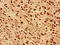 DnaJ Heat Shock Protein Family (Hsp40) Member B5 antibody, CSB-PA007011LA01HU, Cusabio, Immunohistochemistry paraffin image 