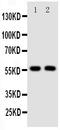 Transforming Growth Factor Beta Receptor 1 antibody, PA1731, Boster Biological Technology, Western Blot image 