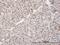 X-Ray Repair Cross Complementing 5 antibody, H00007520-M02, Novus Biologicals, Immunohistochemistry paraffin image 