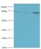 Adenosine Monophosphate Deaminase 3 antibody, MBS968942, MyBioSource, Western Blot image 