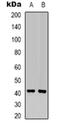Mitogen-Activated Protein Kinase Kinase 6 antibody, orb318937, Biorbyt, Western Blot image 