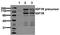Insulin Like Growth Factor 1 Receptor antibody, ADI-905-643-100, Enzo Life Sciences, Western Blot image 