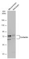 Cortactin antibody, GTX113680, GeneTex, Western Blot image 