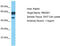 Peptidase M20 Domain Containing 1 antibody, TA331624, Origene, Western Blot image 