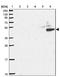 Creatine Kinase, Mitochondrial 2 antibody, NBP2-13841, Novus Biologicals, Western Blot image 