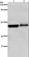Adrenoceptor Beta 2 antibody, LS-C405409, Lifespan Biosciences, Western Blot image 