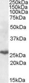 Macropain subunit MECl-1 antibody, MBS421721, MyBioSource, Western Blot image 