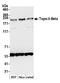 DNA Topoisomerase II Beta antibody, A300-949A, Bethyl Labs, Western Blot image 