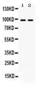 ABR Activator Of RhoGEF And GTPase antibody, PA5-78708, Invitrogen Antibodies, Western Blot image 