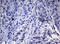 Nibrin antibody, LS-C175618, Lifespan Biosciences, Immunohistochemistry paraffin image 
