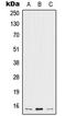 Interleukin 5 antibody, LS-C352368, Lifespan Biosciences, Western Blot image 