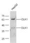 Delta Like Non-Canonical Notch Ligand 1 antibody, GTX60309, GeneTex, Western Blot image 