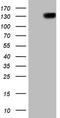 Colony Stimulating Factor 2 Receptor Beta Common Subunit antibody, LS-C340408, Lifespan Biosciences, Western Blot image 