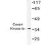 Casein Kinase 1 Alpha 1 antibody, LS-C176768, Lifespan Biosciences, Western Blot image 