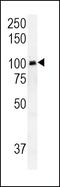 RAS Guanyl Releasing Protein 1 antibody, MBS9206589, MyBioSource, Western Blot image 