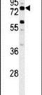 Acyl-CoA Synthetase Bubblegum Family Member 2 antibody, PA5-26853, Invitrogen Antibodies, Western Blot image 